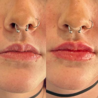 Before and After Photos of ABC Health and Beauty in Los Altos, CA