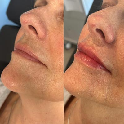 Before and After Photos of ABC Health and Beauty in Los Altos, CA