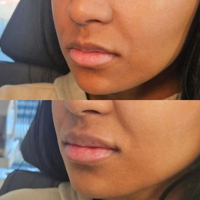 Before and After Photos of ABC Health and Beauty in Los Altos, CA