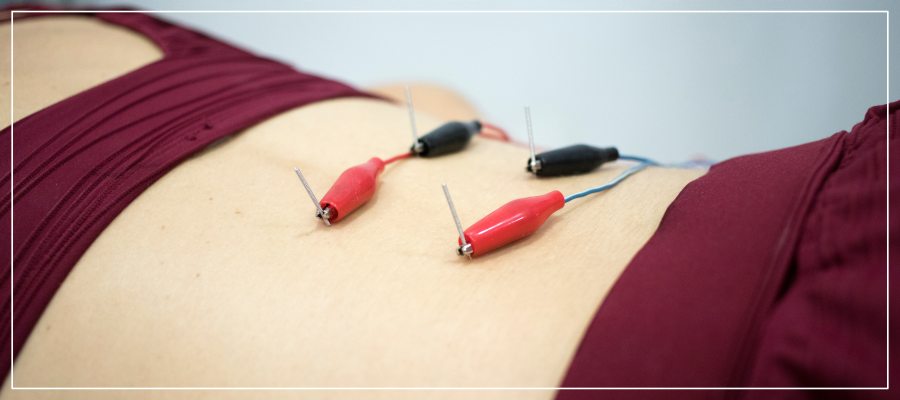Dry Needling Specialist in Los Altos, CA