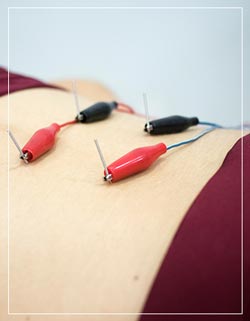 Dry Needling Near Me in Los Altos, CA