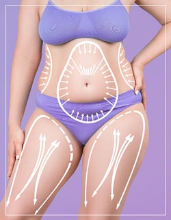 Fat Reduction Near Me in Los Altos, CA