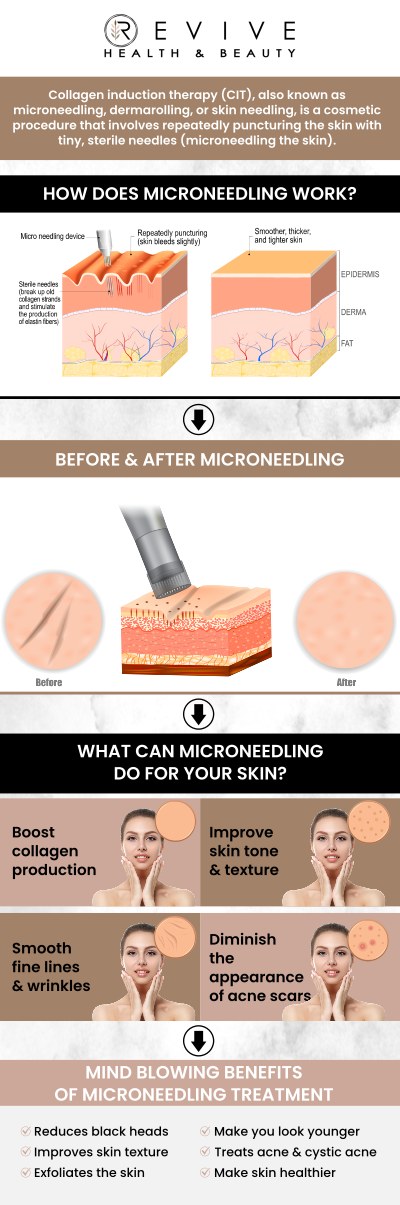 Common questions asked by clients: What is microneedling with PRP? What skin concerns can microneedling with PRP treat? Is the microneedling with PRP procedure safe? Who is a good candidate for microneedling with PRP? For more information, contact us or schedule an appointment online. We are conveniently located at 123 ABC Ave Suite A, Los Altos, CA 123456. Common questions asked by clients: What is microneedling with PRP? What skin concerns can microneedling with PRP treat? Is the microneedling with PRP procedure safe? Who is a good candidate for microneedling with PRP? For more information, contact us or schedule an appointment online. We are conveniently located at 123 ABC Ave Suite A, Los Altos, CA 123456.