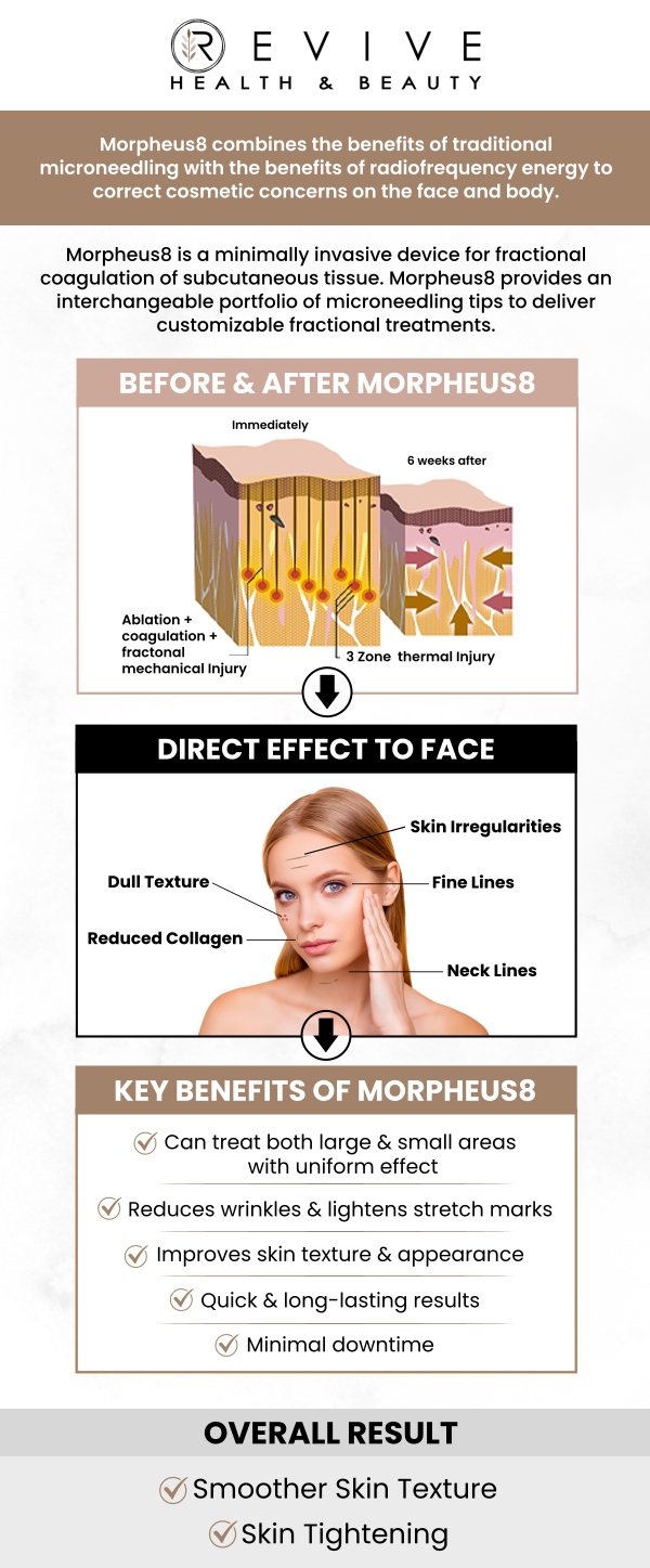 Common questions asked by clients: What is Morpheus8 Treatment? What areas can Morpheus8 treat? What’s the downtime after Morpheus8? Can Morpheus8 be combined with other treatments? For more information, contact us or schedule an appointment online. We are conveniently located at 123 ABC Ave Suite A, Los Altos, CA 123456.