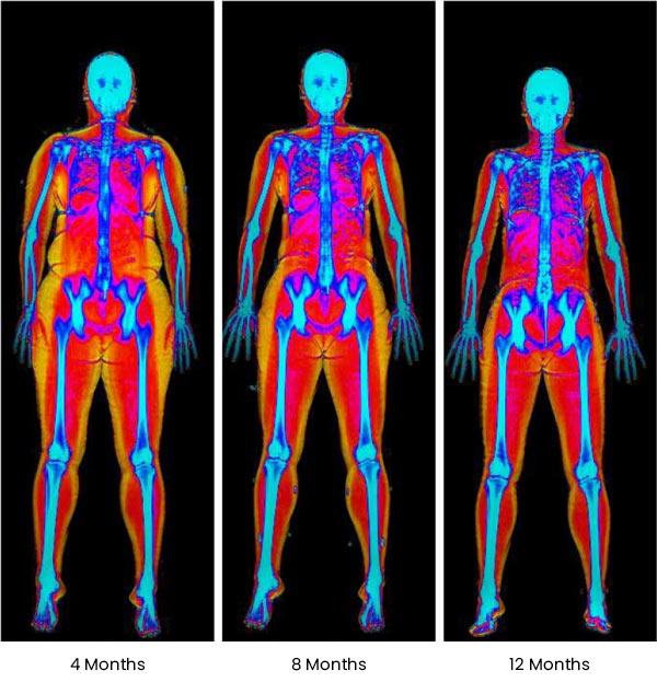 At ABC Health & Beauty, we specialize in medical weight loss programs tailored to your unique needs. Located in Los Altos, CA, our experienced team works with you to design a personalized weight loss plan that addresses your goals and lifestyle. From nutritional guidance to personalized support, our comprehensive approach ensures you receive the care you need to succeed. Contact us today or book an appointment online. We are conveniently located at 123 ABC Ave Suite A, Los Altos, CA 123456. At ABC Health & Beauty, we specialize in medical weight loss programs tailored to your unique needs. Located in Los Altos, CA, our experienced team works with you to design a personalized weight loss plan that addresses your goals and lifestyle. From nutritional guidance to personalized support, our comprehensive approach ensures you receive the care you need to succeed. Contact us today or book an appointment online. We are conveniently located at 123 ABC Ave Suite A, Los Altos, CA 123456.