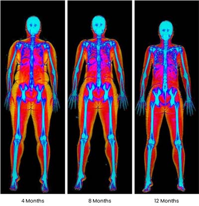 At ABC Health & Beauty, we specialize in medical weight loss programs tailored to your unique needs. Located in Los Altos, CA, our experienced team works with you to design a personalized weight loss plan that addresses your goals and lifestyle. From nutritional guidance to personalized support, our comprehensive approach ensures you receive the care you need to succeed. Contact us today or book an appointment online. We are conveniently located at 123 ABC Ave Suite A, Los Altos, CA 123456. At ABC Health & Beauty, we specialize in medical weight loss programs tailored to your unique needs. Located in Los Altos, CA, our experienced team works with you to design a personalized weight loss plan that addresses your goals and lifestyle. From nutritional guidance to personalized support, our comprehensive approach ensures you receive the care you need to succeed. Contact us today or book an appointment online. We are conveniently located at 123 ABC Ave Suite A, Los Altos, CA 123456.