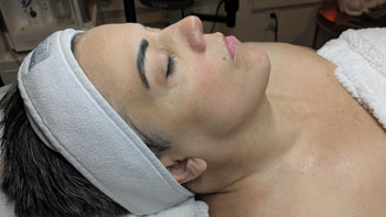FORMA Treatment Before and After Photos of ABC Health and Beauty in Los Altos, CA