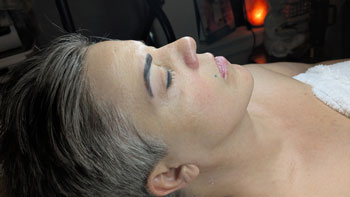 FORMA Treatment Before and After Photos of ABC Health and Beauty in Los Altos, CA